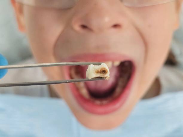 Best Emergency Care for Gum Disease in Dickson, TN